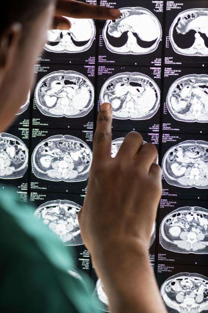 Evaluación y diagnóstico del daño cerebral adquirido